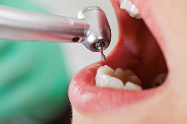 Best Emergency Dental Extractions in Ray City, GA